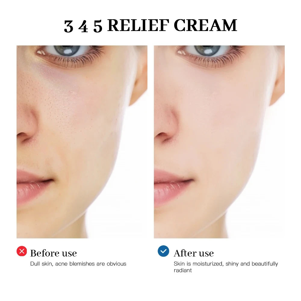 345 Relief Barrier Cream